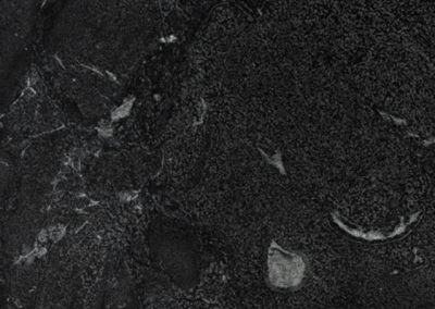 MISTERY BLACK (C)